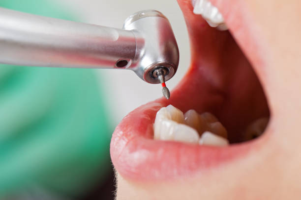 Best Pediatric Emergency Dentist in Bicknell, IN